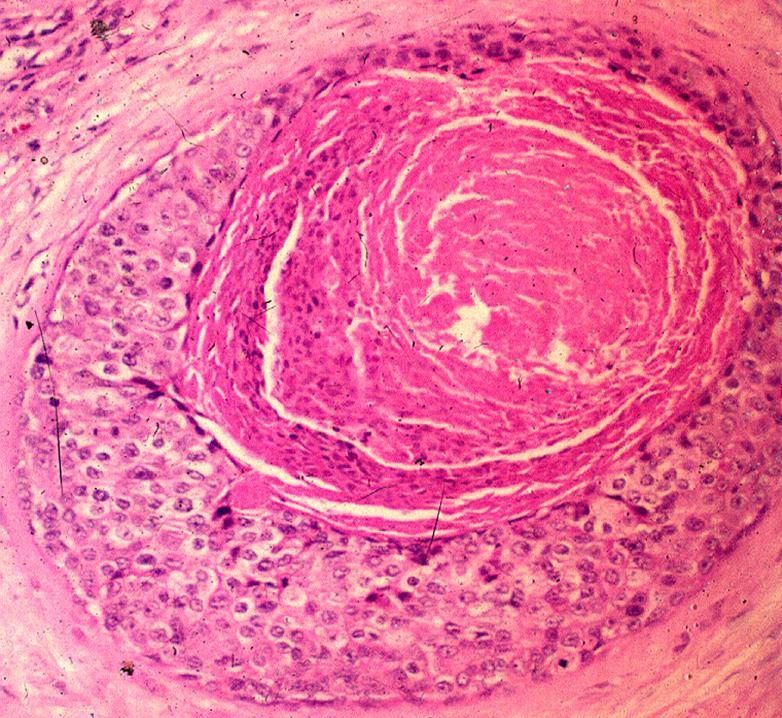 Παθήσεις Μαστού Tsagkatakis Thomas Breast